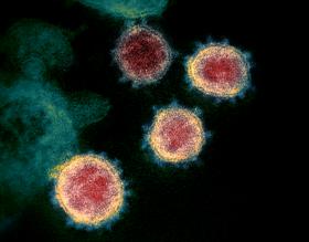 Das Coronavirus SARS-CoV-2 unter mikroskopischer Vergrößerung
